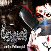 Leprasy - Morbid Pathologist