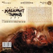Malignant Tumour - And Some Sick Parts Rotting Out There 1992-2002